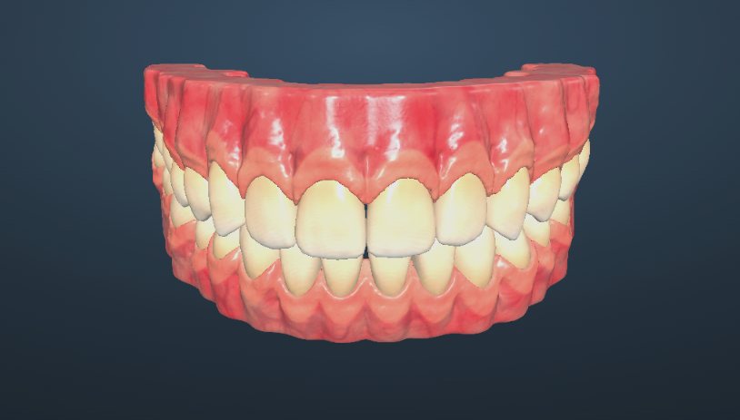 Arcades dentaires en 3D dans la visionneuse Reveliodental